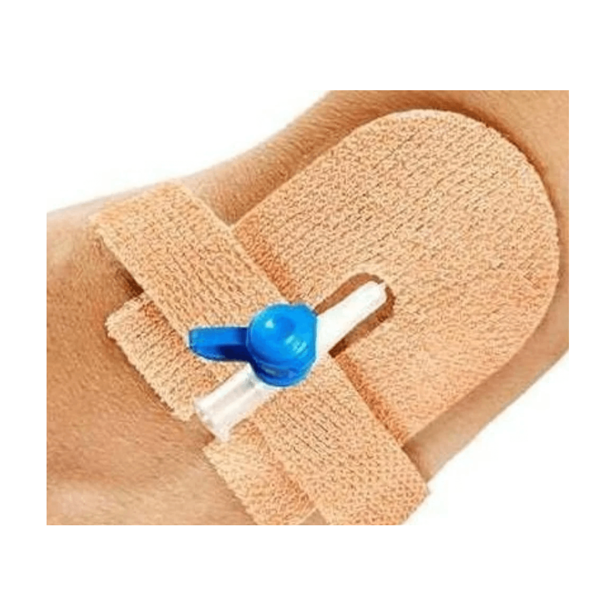Cannula Fixer